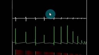 Action potential propagation [upl. by Chrystal225]