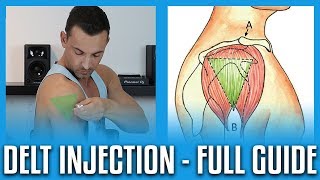 How To Do A Deltoid Injection  Full GuideDemo [upl. by Thilda881]