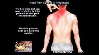 Common Causes of Neck Pain [upl. by Nylcaj]