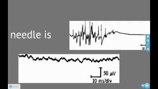 EMG and Action Potentials [upl. by Flory]