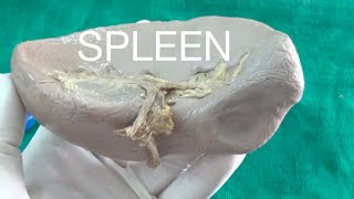 SPLEEN  Demonstration Anatomy [upl. by Waynant]