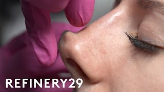 I Tried A NonSurgical Nose Job  Macro Beauty  Refinery29 [upl. by Raycher]