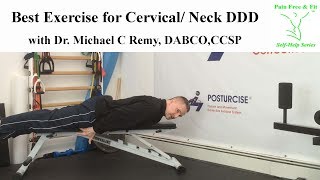 Best Exercise for Cervical Neck Degenerative Disc Disease [upl. by Washburn]