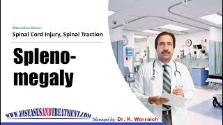 Spleenomegaly Enlarged Spleen  Causes Diagnosis Symptoms Treatment Prognosis [upl. by Iramat]