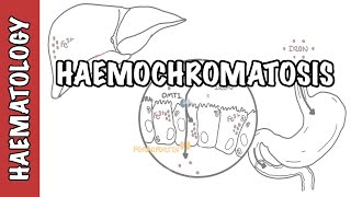 Haemochromatosis Iron Overload  iron physiology causes and pathophysiology [upl. by Amsirhc627]