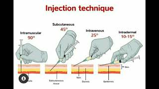 Injection Techniques quotIntermuscular Subcutaneous Intravenous Intradermalquot [upl. by Gwenny720]