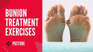 How To Treat Bunions Part 1  Home mobilization exercise [upl. by Tyika982]