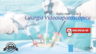 Cirurgia Videolaparoscópica [upl. by Notsua927]