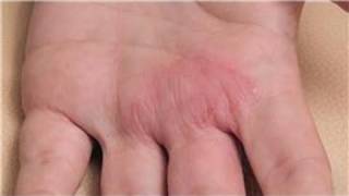 Dermatology Treatments  How to Diagnose Skin Rashes [upl. by Nerissa]