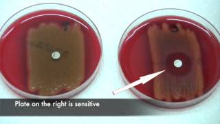 Bacitracin test for Streptococcus pyogenes [upl. by Ydnagrub]