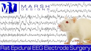 Fundamentals of EEG Signal [upl. by Ck570]