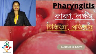 Pharyngitis In Bangla  Causes  Treatments  Home Remedies [upl. by Fortunna]