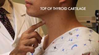 The Thyroid Exam Stanford Medicine 25 [upl. by Yancy]