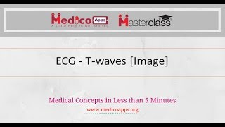 ECG – T waves Image [upl. by Annekahs]