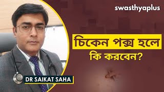 চিকেনপক্স হলে কি করবেন  Chickenpox in Bangla  Signs amp Prevention  Dr Saikat Saha [upl. by Areip]