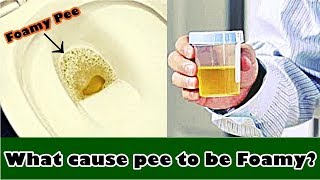 Frothy Urine – What cause pee to be Foamy [upl. by Ocisnarf135]