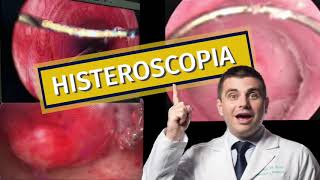 Histeroscopia [upl. by Luba645]