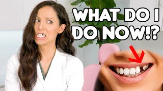 How To REPLACE A Missing Tooth Best Tooth Replacement Options [upl. by Buseck]