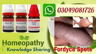 Fordyce spots homeopathic treatments risk factors and symptoms in hindi [upl. by Sitruk41]