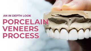 Porcelain Veneers A Dental Boutique Process  An In Depth Look [upl. by Arie]