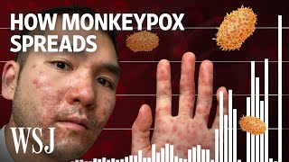 Why Monkeypox Is a Global Health Threat  WSJ [upl. by Dagnah585]