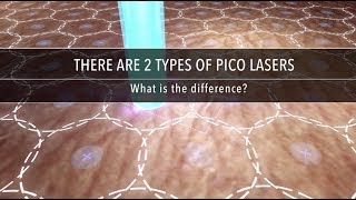 Why Are There Different Types of Pico Laser  Dr Kenneth Thean [upl. by Etnomal64]