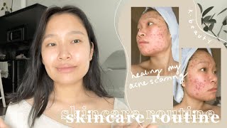 my holy grail skincare routine  how I healed my severe acne scarring texture amp hyperpigmentation [upl. by Nyla129]