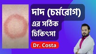 দাদ চর্মরোগ এর চিকিৎসা  Ringworm treatment  Dr Costa [upl. by Irakab]