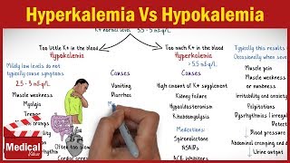 Hyperkalemia Vs Hypokalemia  EASY TO REMEMBER [upl. by Anaizit428]