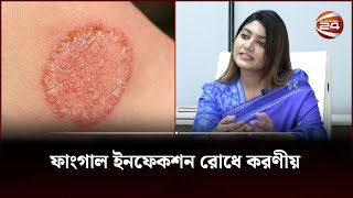 ফাংগাল ইনফেকশন রোধে করণীয়  Fungal infection  Channel 24 [upl. by Meela]