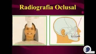 Radiografia Oclusal  Radiodoc [upl. by Akinuahs863]