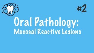 Oral Pathology  Mucosal Reactive Lesions  INBDE ADAT [upl. by Bellis]