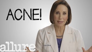 What is Acne and How Do I Get Rid of it Forever  Allure [upl. by Dustan]