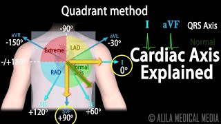 Cardiac Axis Interpretation Animation [upl. by Reyaht55]