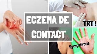 LECZEMA DE CONTACT ALLERGIQUE  CAUSES  SYMPTOMES  COMPLICATIONS  TRAITMENT [upl. by Airdnua]