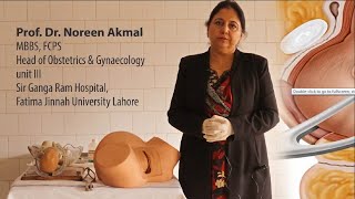 Prof Dr Noreen Akmal  Forceps Delivery Part 1 [upl. by Prosperus]