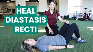 Exercises to Fix Your Diastasis Recti  Physical Therapy [upl. by Ennovihc956]