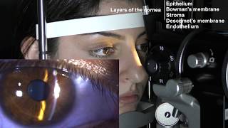 Ophthalmic Skills Series Part 15 [upl. by Etterrag]