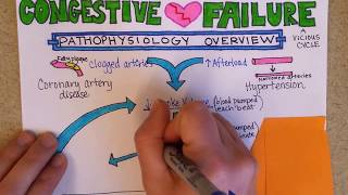 Congestive Heart Failure Pathophysiology [upl. by Annohs]